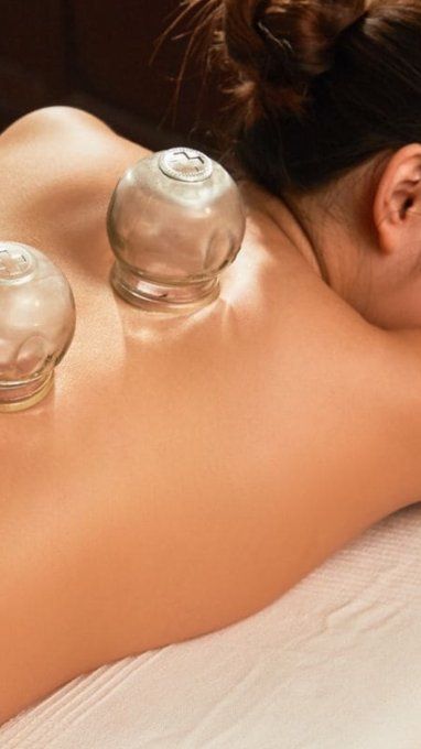 Ventouse - Cupping Thérapie - Hijama 