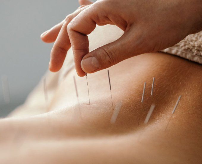 Acupuncture et Réflexologie faciale