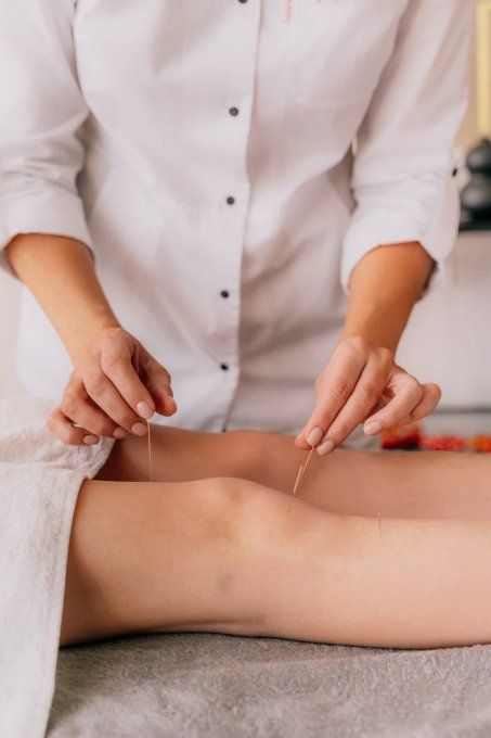 Acupuncture et Réflexologie faciale