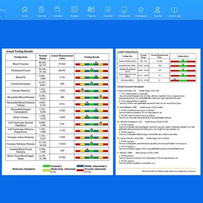 Analyseur Quantique  